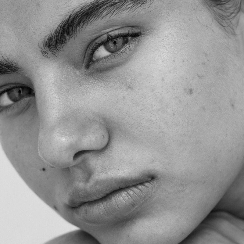 Medi Glow Laser Genesis Facial